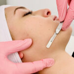 a woman getting a facial peel from a doctor